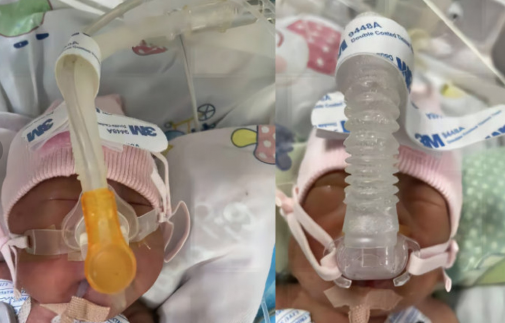鄭州兒童醫院有一對雙胞胎因早產而出現多個嚴重疾病，需要龐大醫藥費。