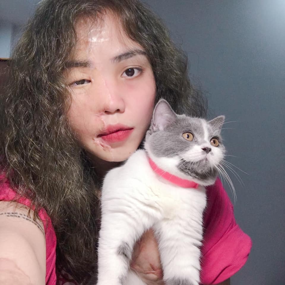 男子最終被判入獄6年，Vy也展開漫長康復旅程。