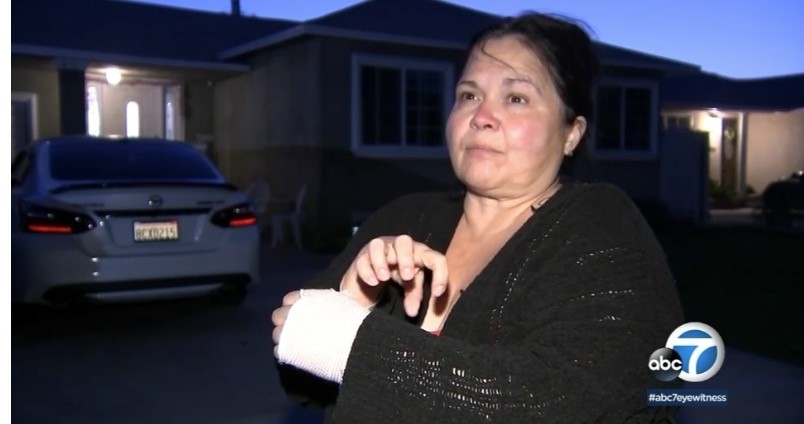 女童祖母手臂被咬傷。