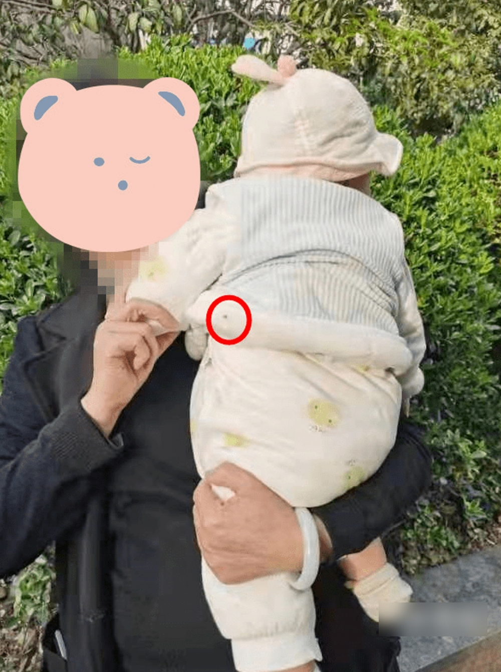 一名男嬰被高處掉下的煙頭擲中。