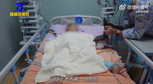 所幸目前幼童成功脫離險境。