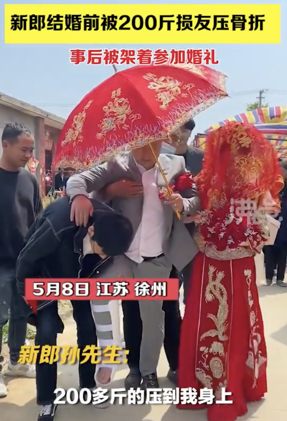 孫姓新郎在婚禮前一晚和朋友們舉行了婚鬧儀式,結果玩鬧中一名重約220磅的友人不小心壓在了他身上,導致他的小腿骨折。