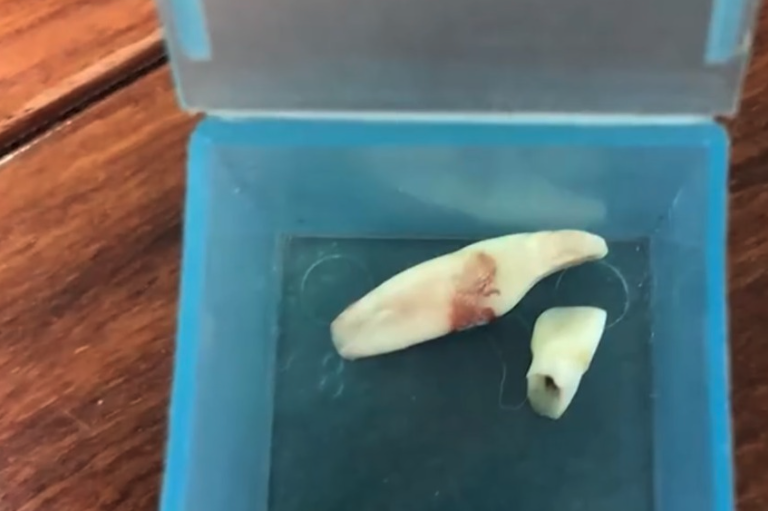 事件揭發馬醫生是無牌牙醫。