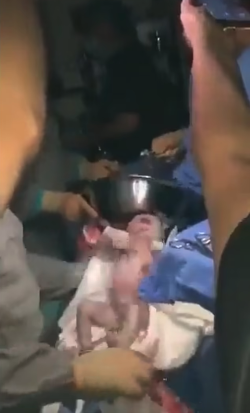 墨西哥發生一宗分娩時的醫療事故。