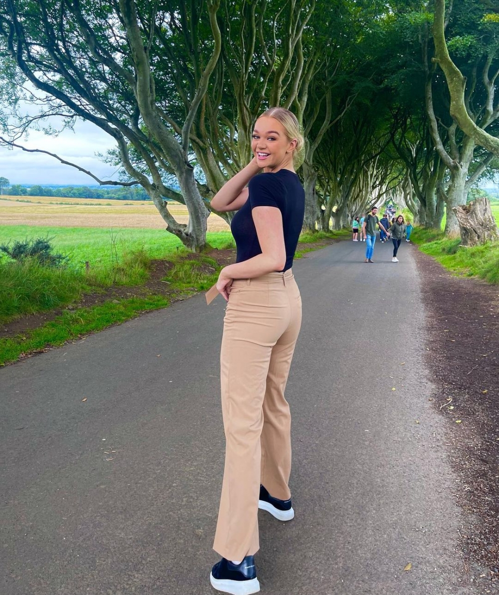 21歲的Harriotte在12歲那年經歷嚴重燙傷意外。