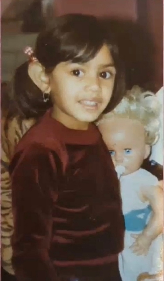 7歲那年，Sheetal的身上開始出現白斑。