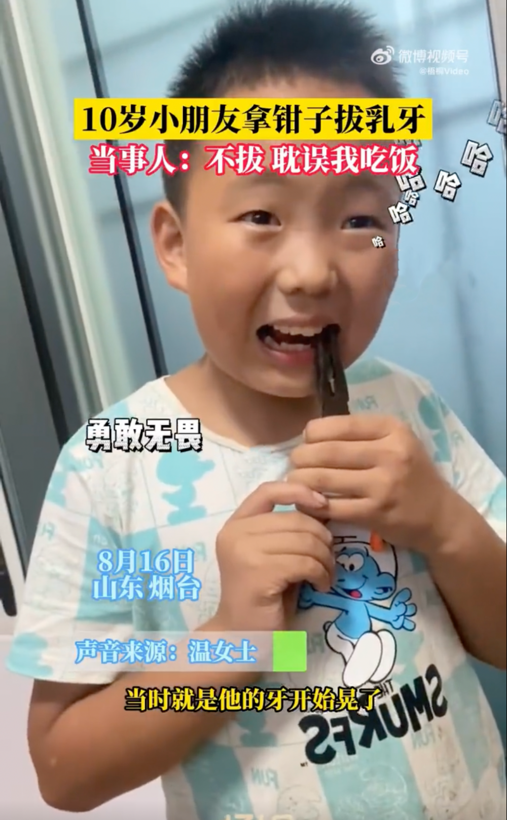 內地一名男童在吃飯時發現乳齒變鬆。