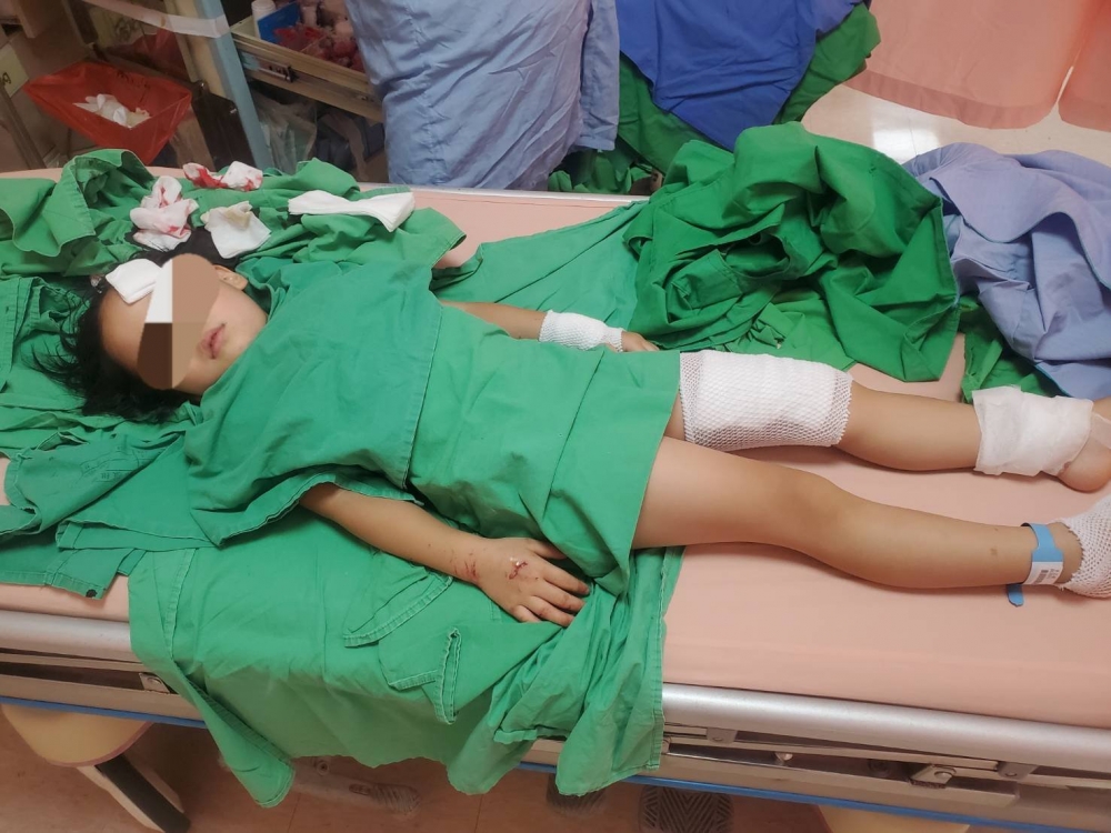 李先生的大女兒受傷最嚴重。