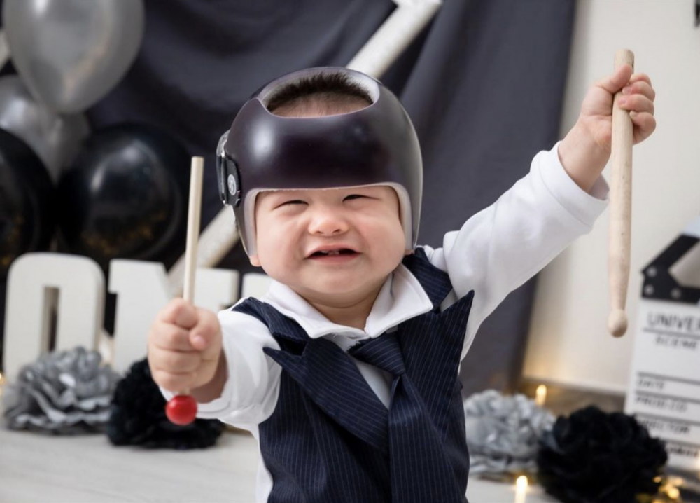 Tristan經過5個多月治療,終於除下頭盔畢業了!