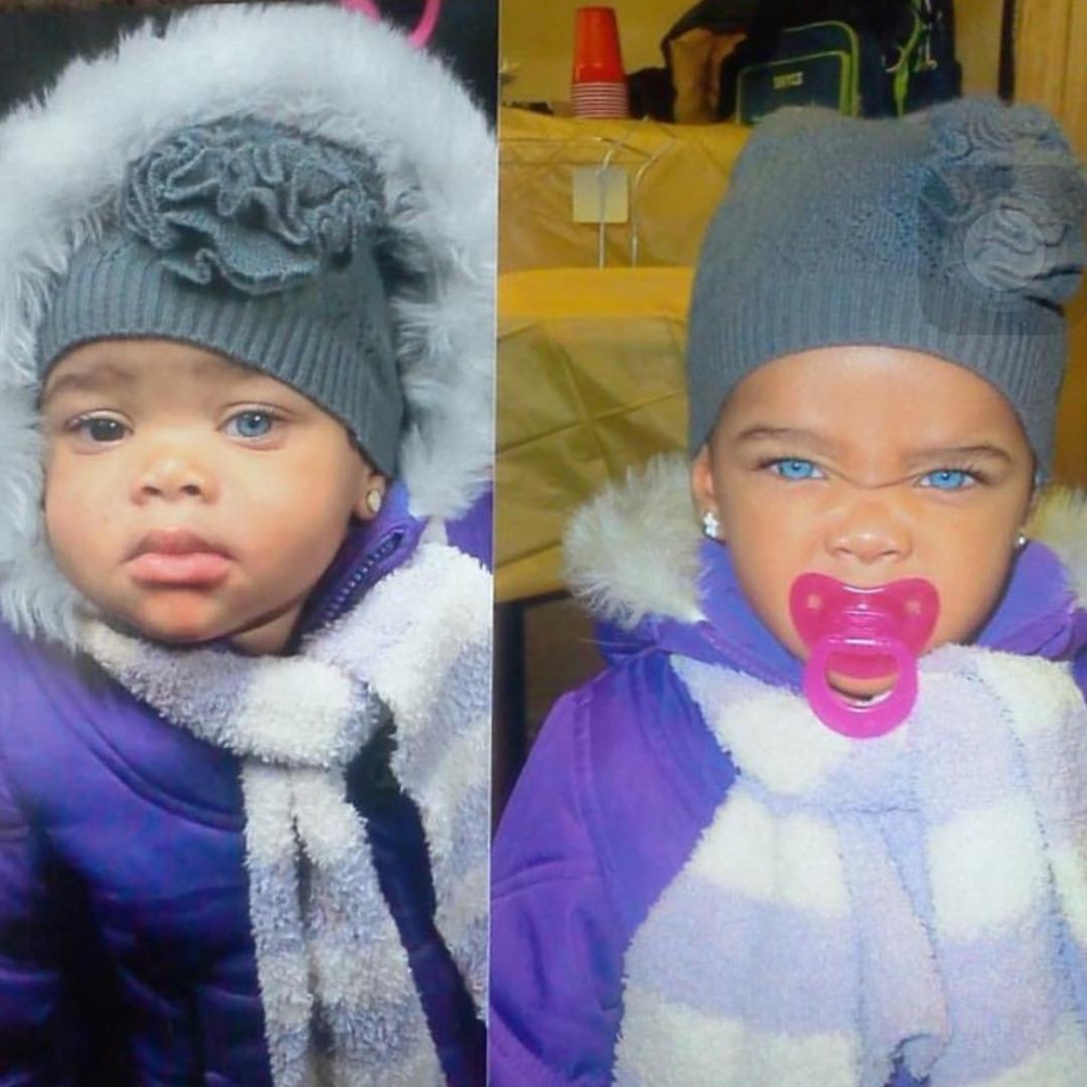 姐妹倆無需外在物品辨別誰是誰,睜開雙眼後就一目了然。