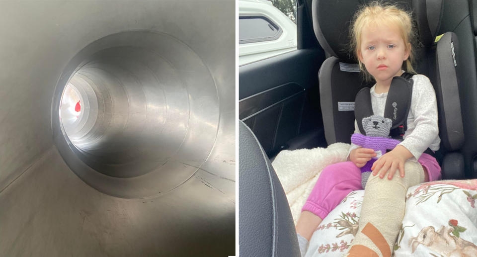 父親相信是因為滑梯陡峭，加上下滑速度快導致女兒受傷。