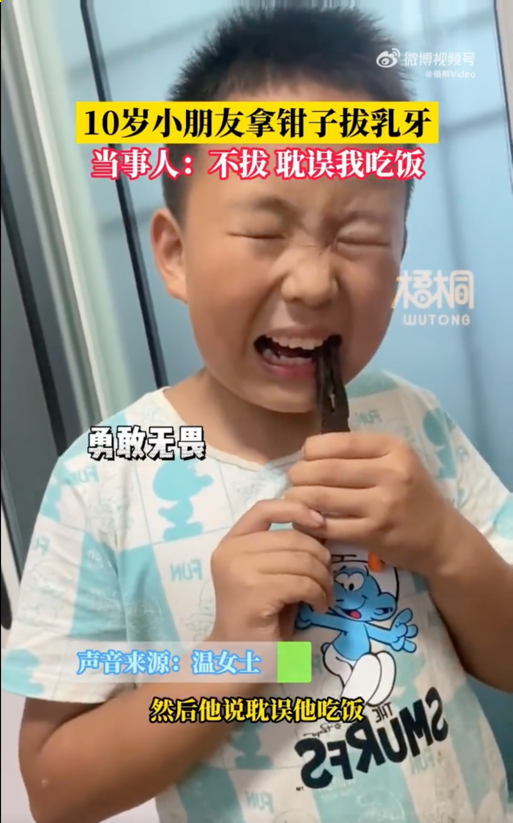 男童於是自行拿鉗將牙拔掉。