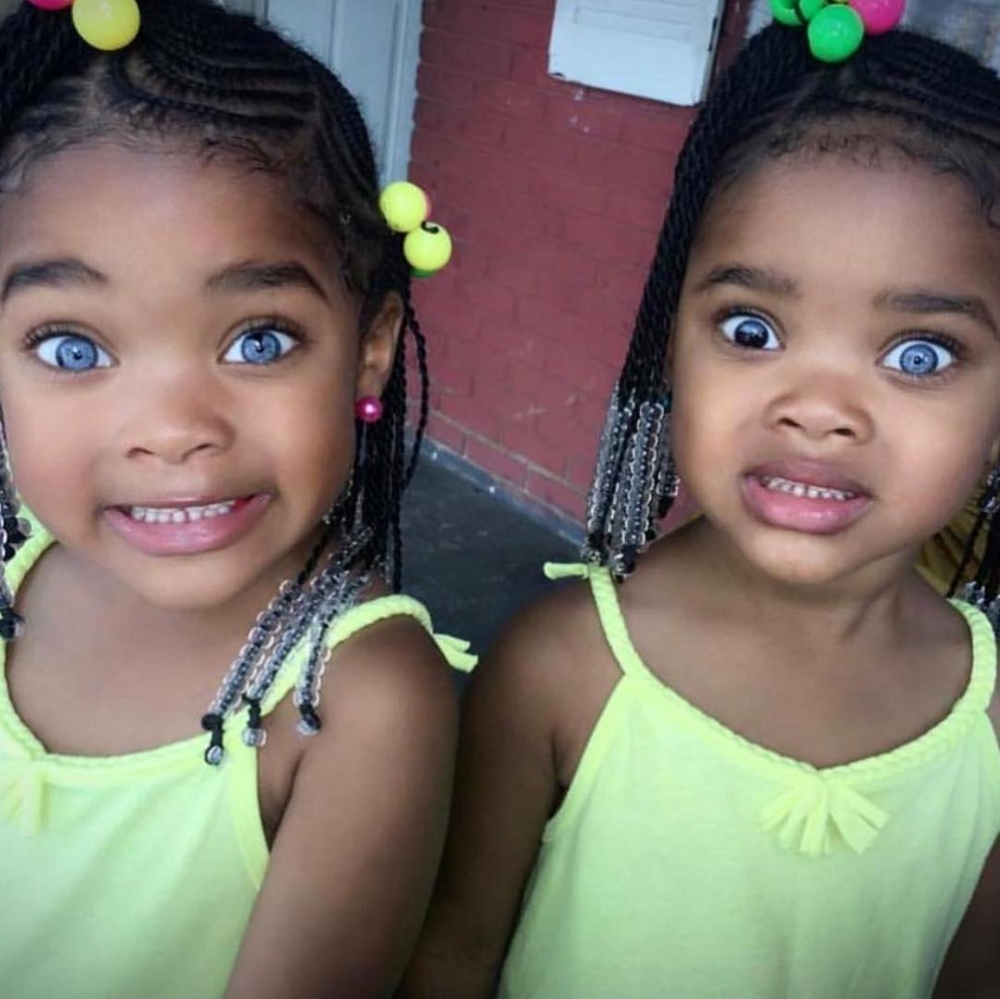 異色瞳形成原因和先天遺傳及後天影響有關。