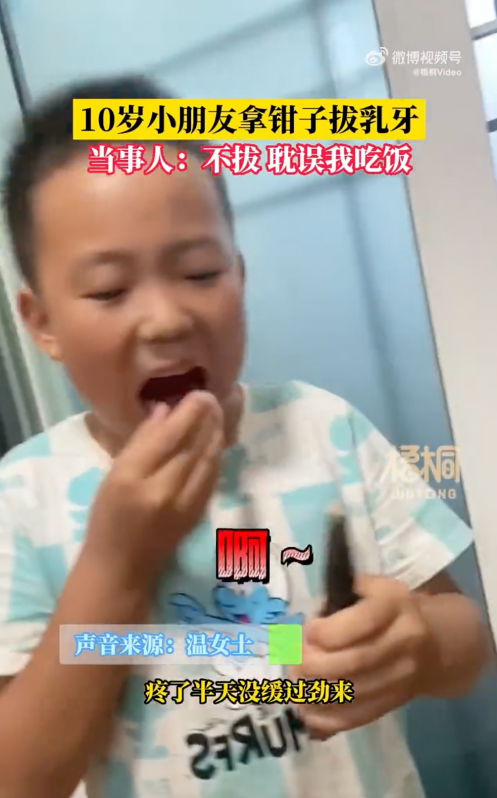 拔牙後男童痛得大叫。