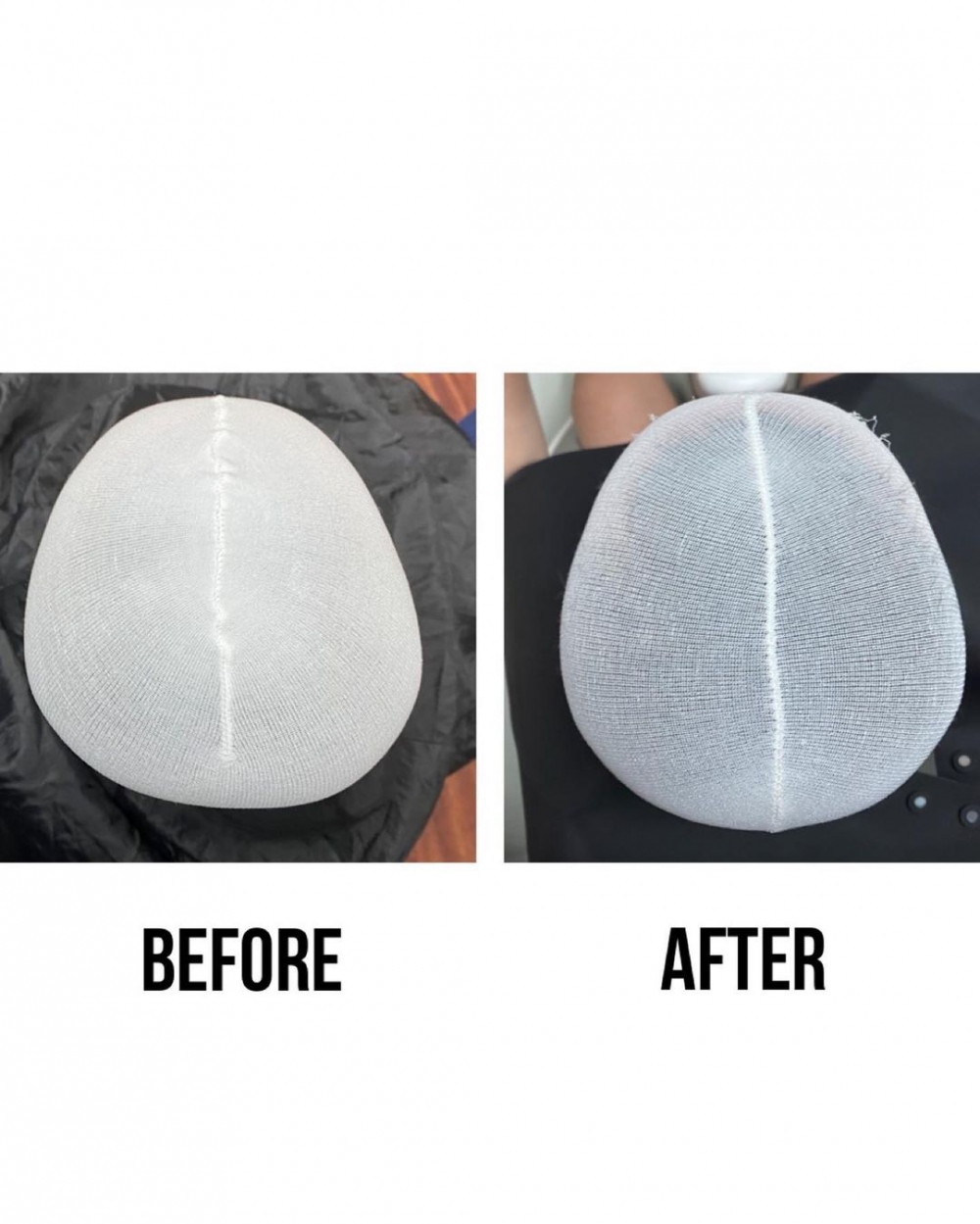 Tristan經治療後,頭部情況大有改善。