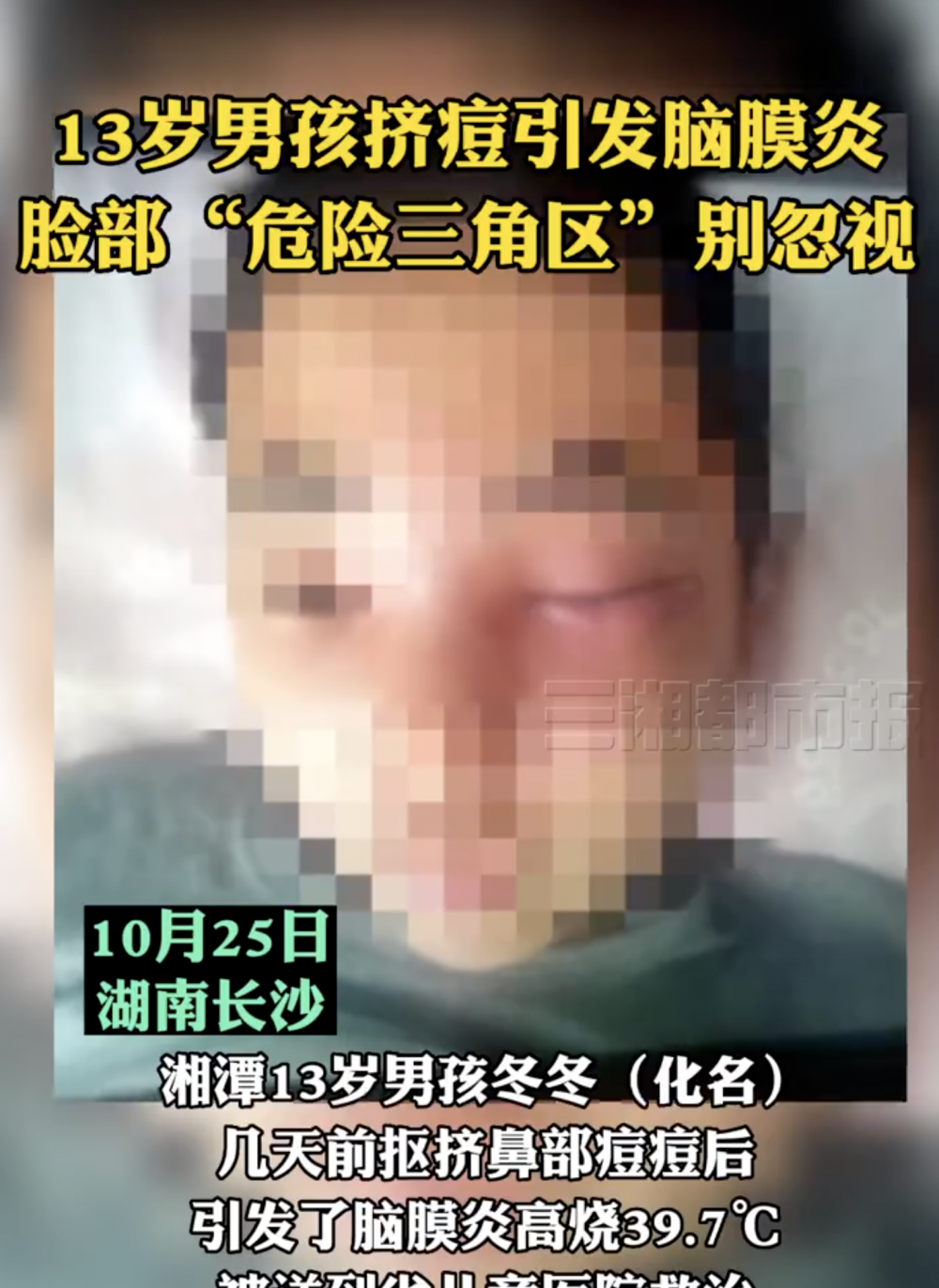 男童臉上出現嚴重紅腫。