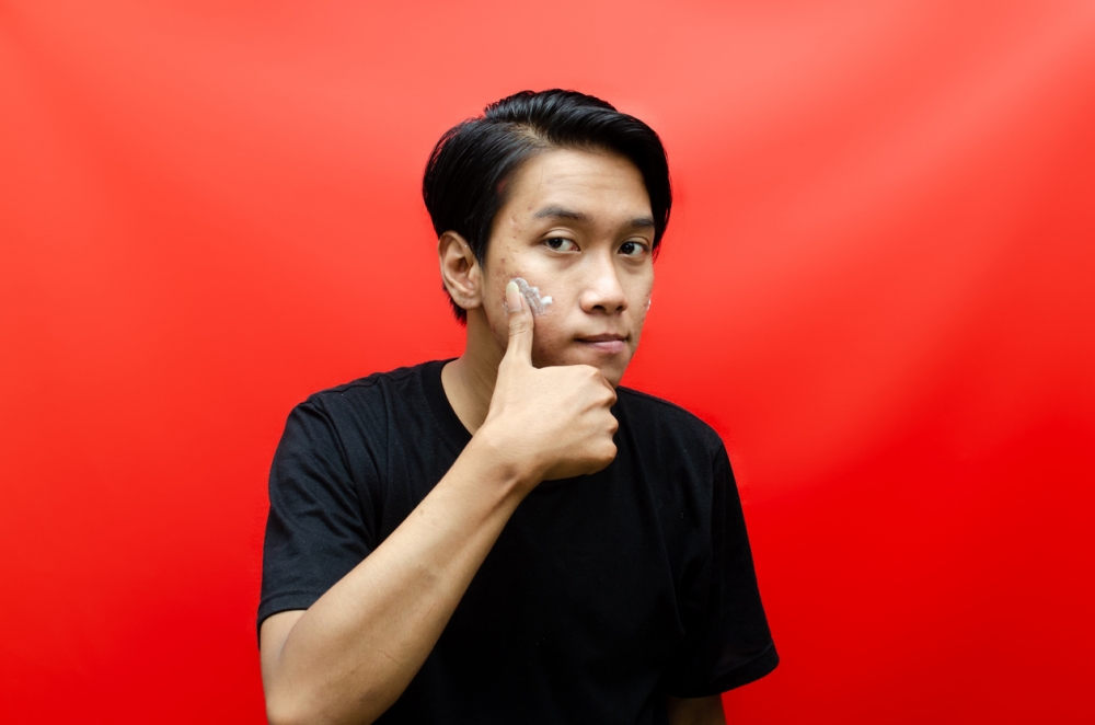 男童因擠臉上暗瘡而患上腦膜炎。