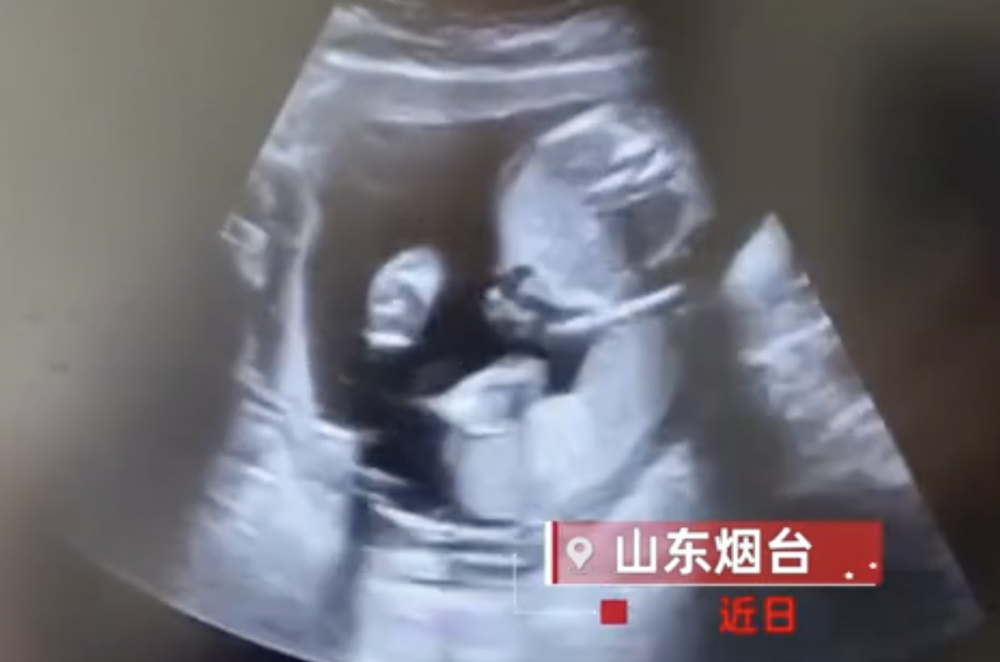 第二胎寶寶的名字也已經想好，以媽媽的姓取名為「閆總」。