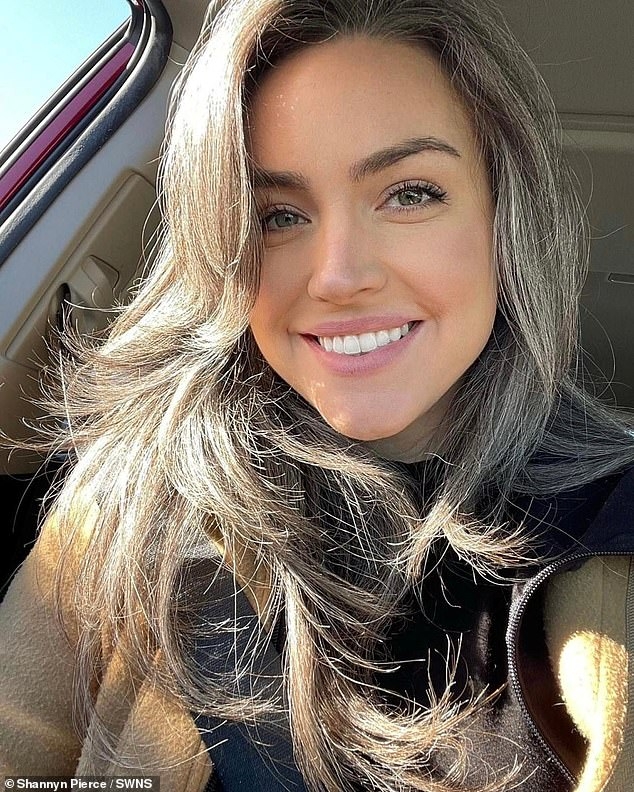 這名來自美國的媽媽出現少白頭,因此高中時遭到欺凌而開始染髮。