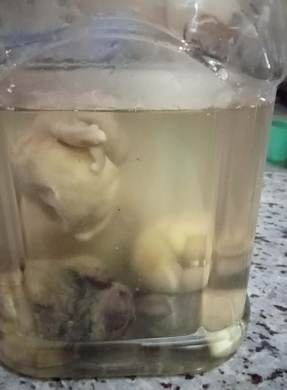 8個寄生胎案例創下全球紀錄。