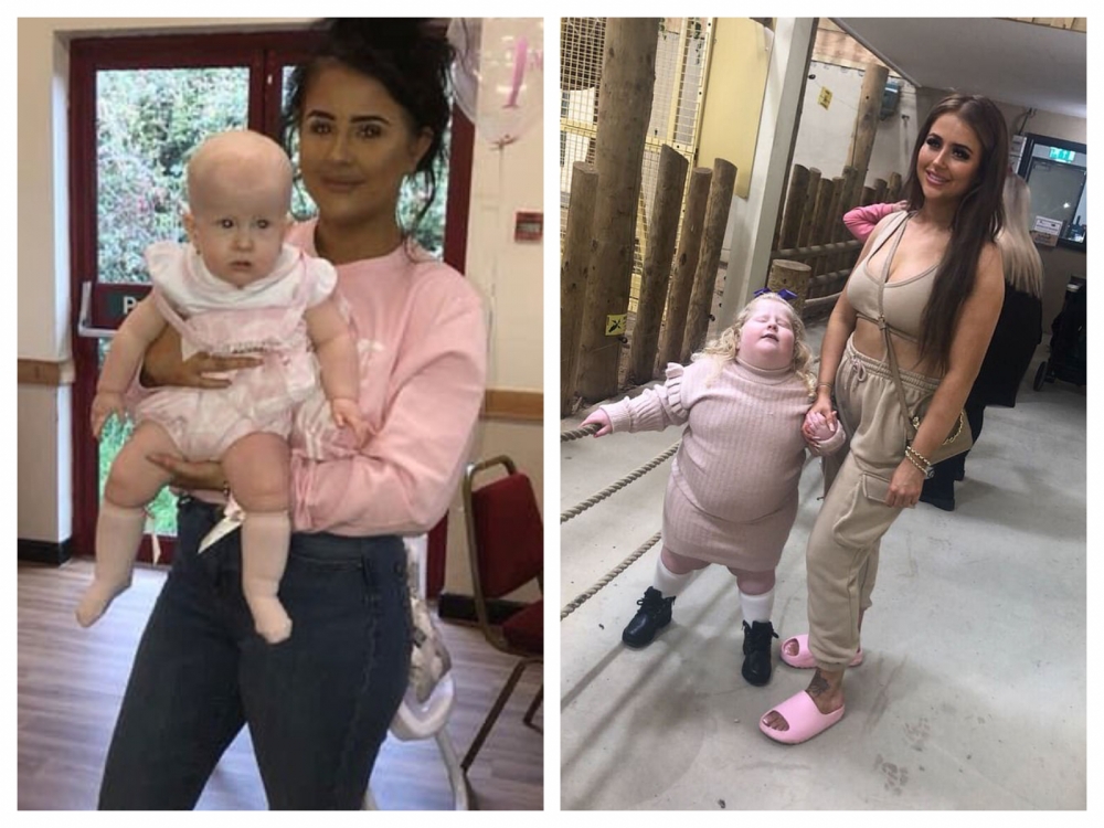 Harlow剛出生時比起正常嬰兒體積要小，然而卻在6個月後確診「小胖威利症」。