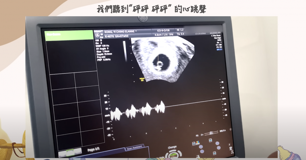 Elanne說聽到BB心跳聲，內心立即踏實了。