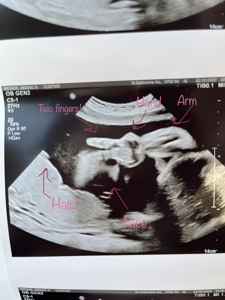 有網民質疑照片,Kyle再上載比「Yeah」照之前BB的動靜。